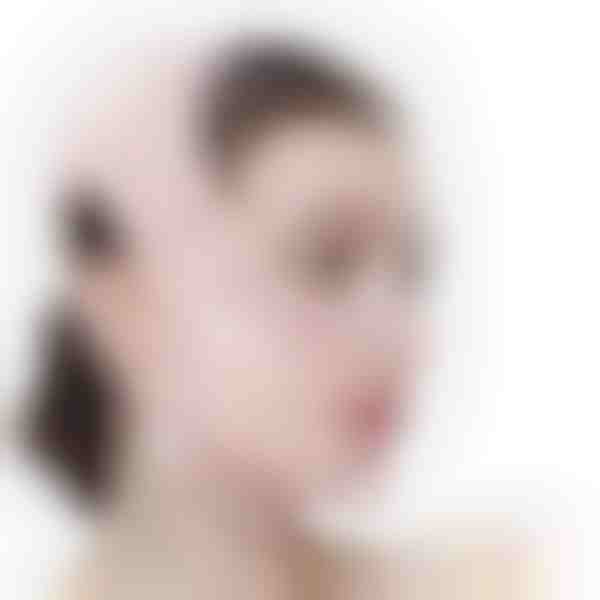 Band für Gesichtslifting und Kieferkonturierung | KIMLIFT